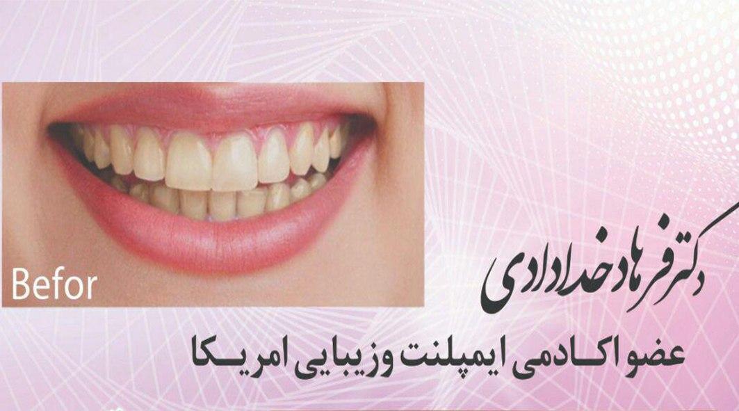 عکس مطب
