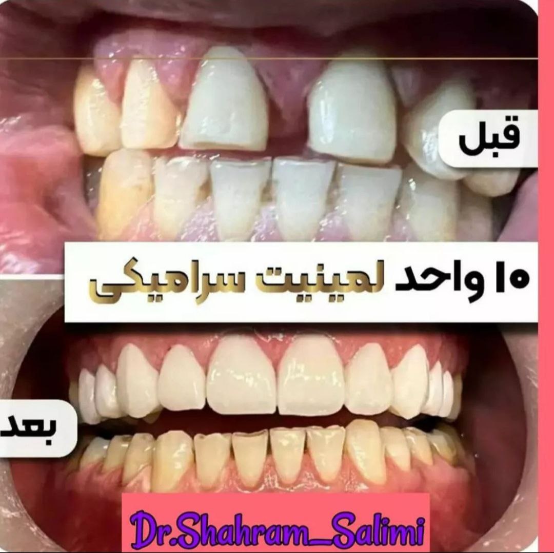 عکس مطب