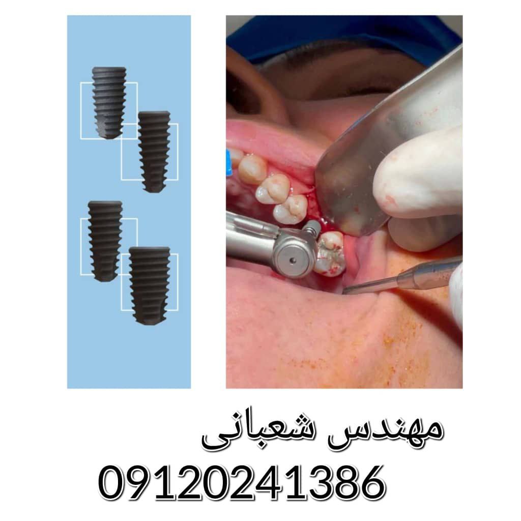 عکس مطب