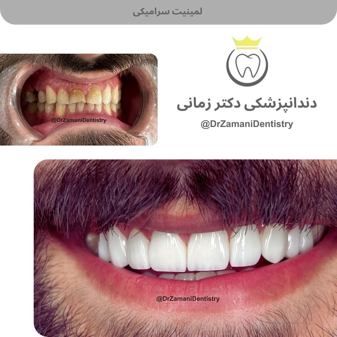 عکس مطب