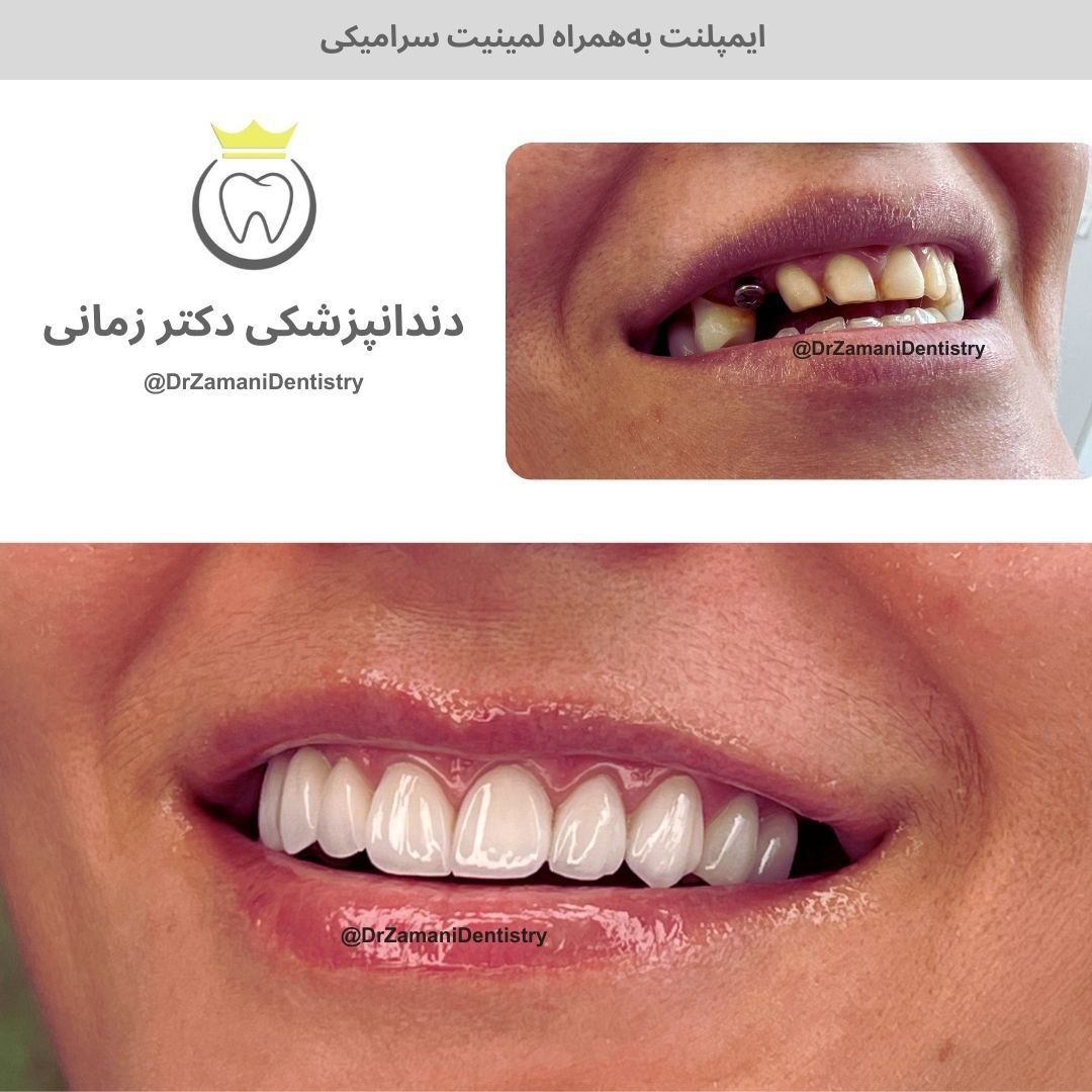 عکس مطب
