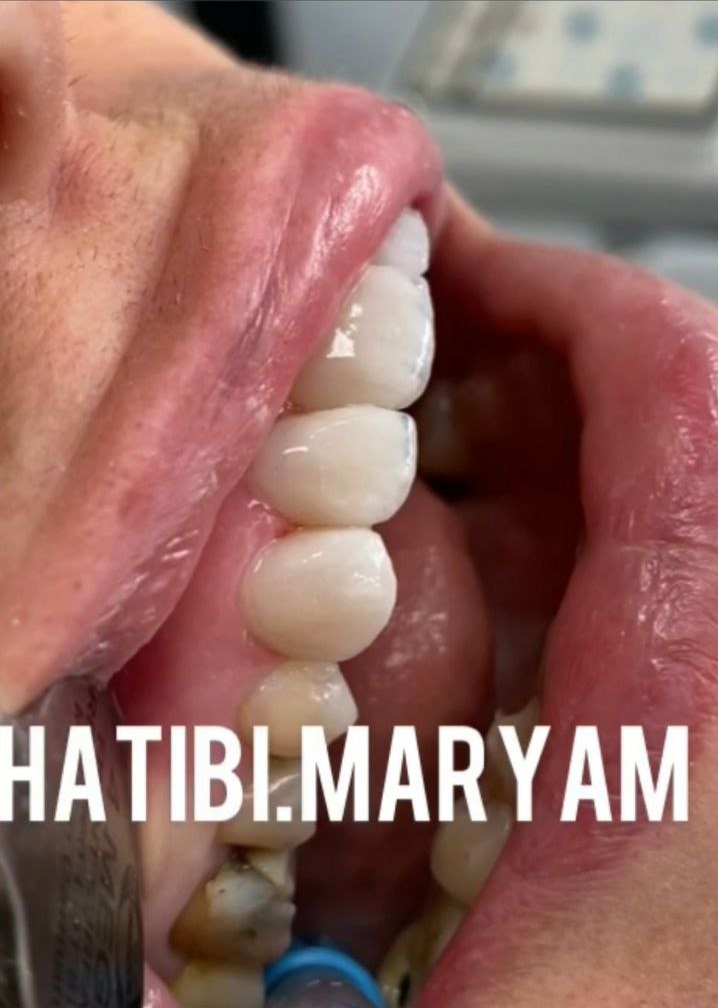 عکس مطب