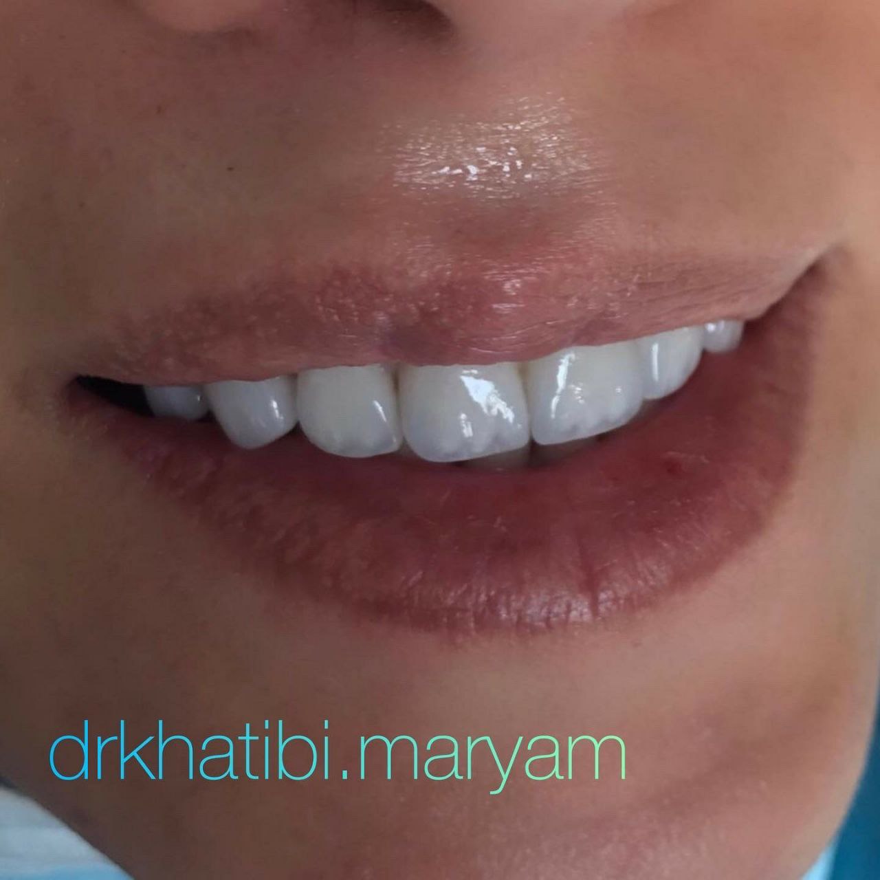 عکس مطب
