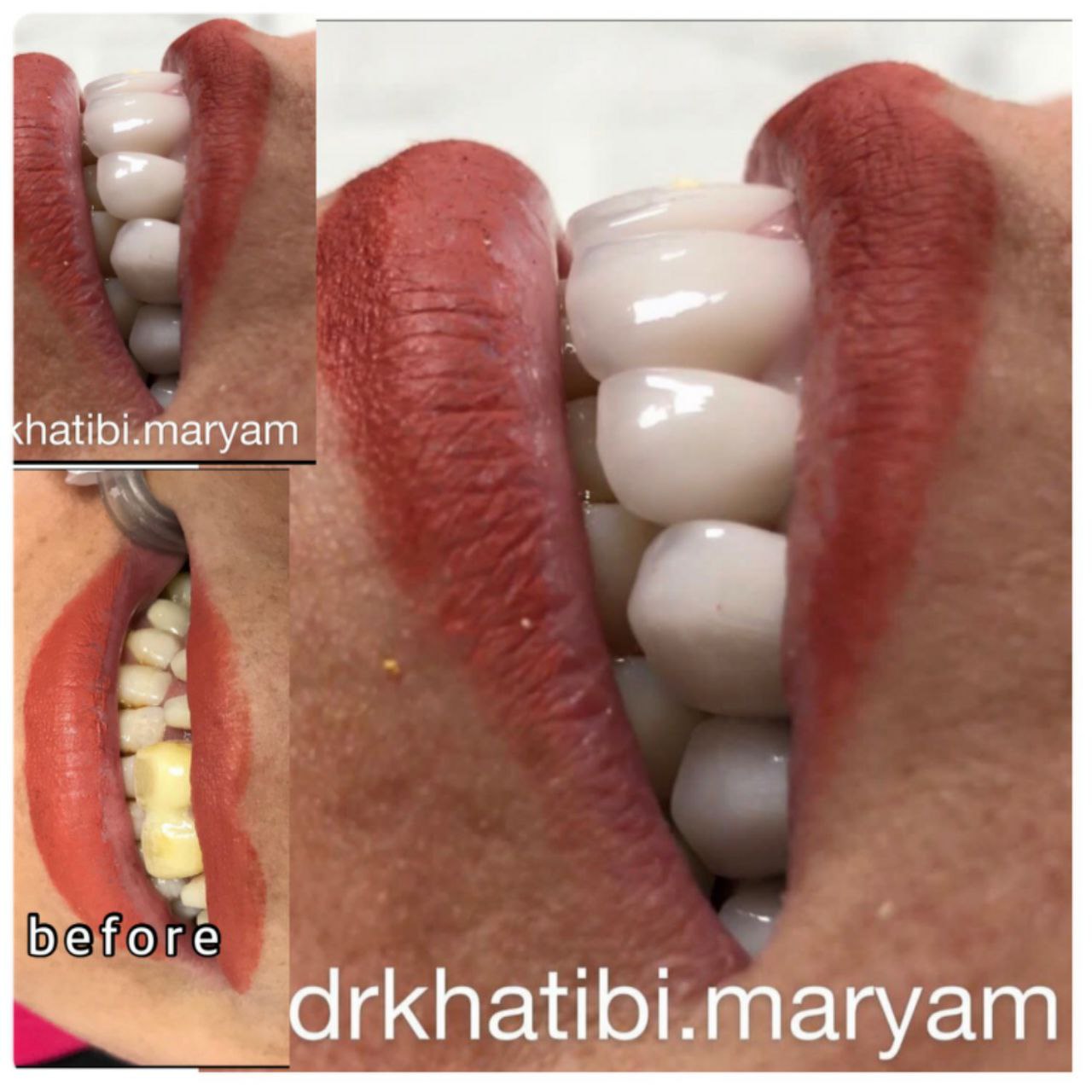 عکس مطب