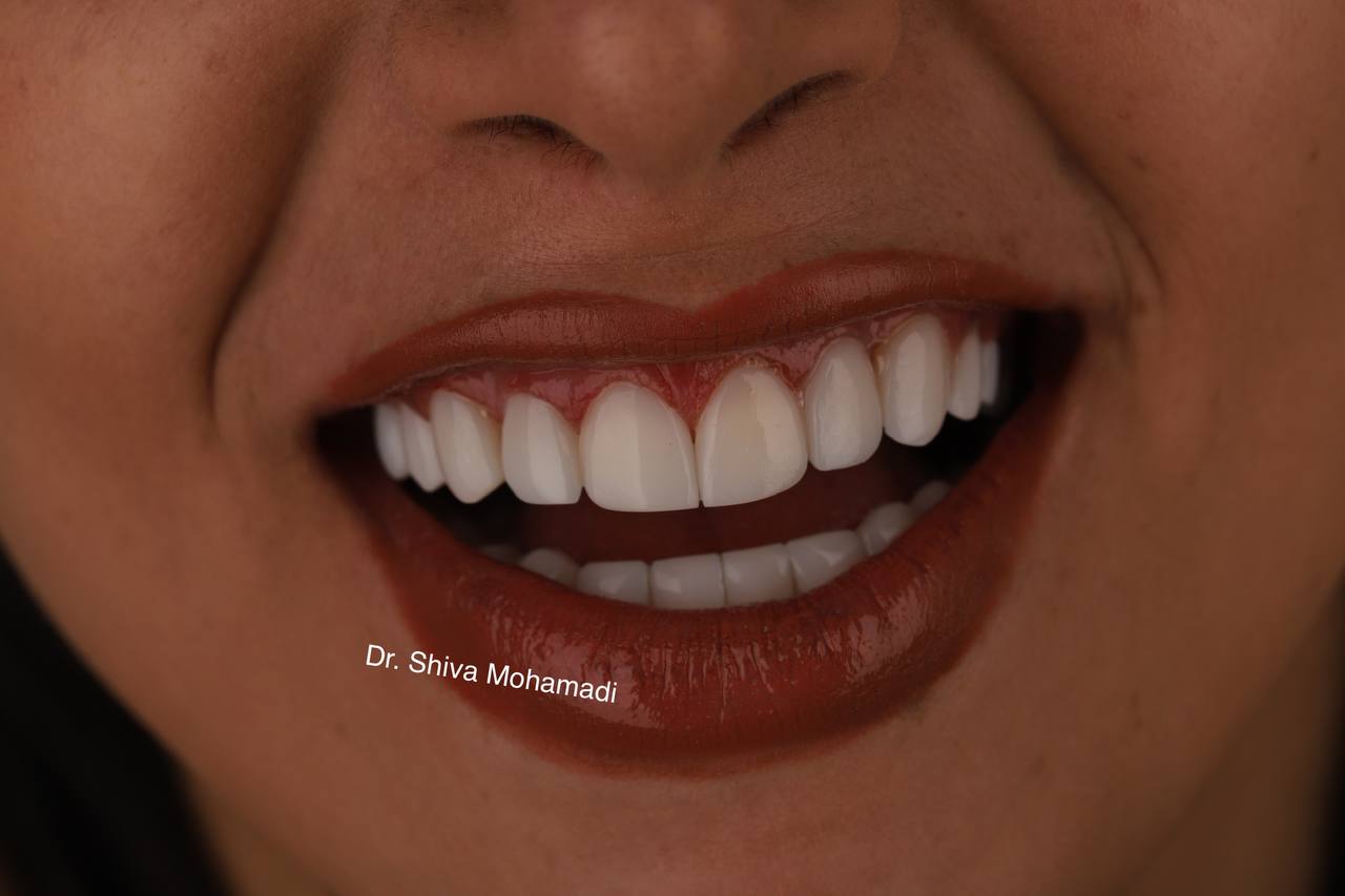 عکس مطب