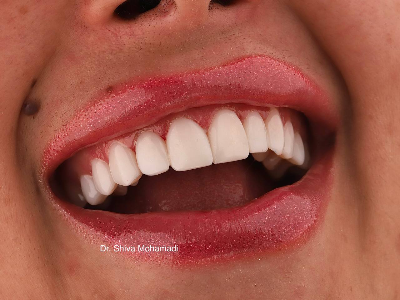عکس مطب