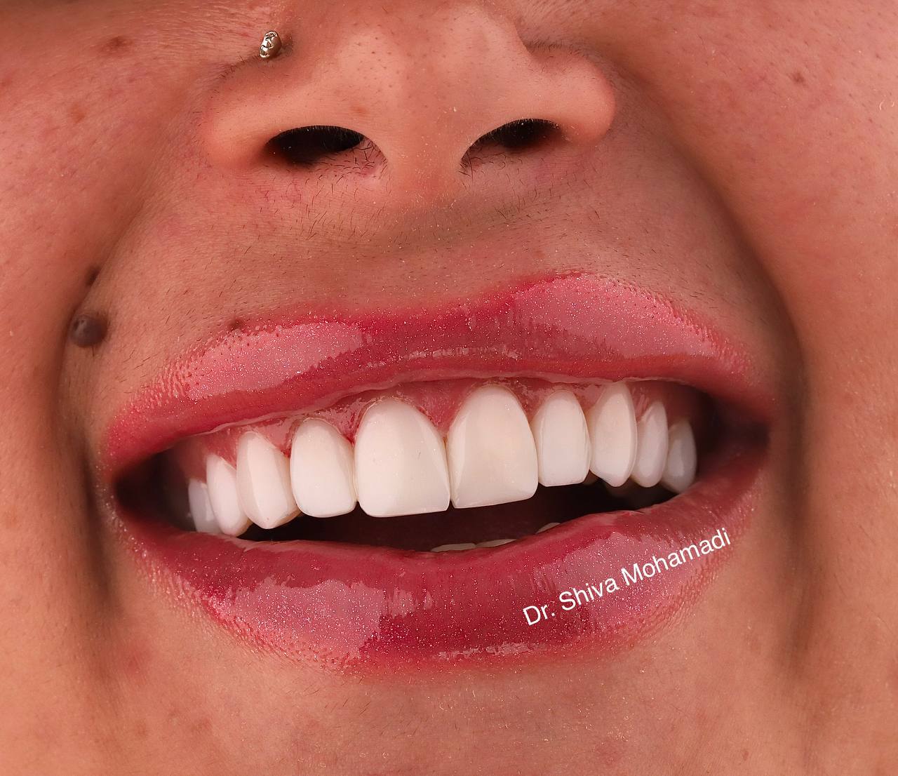 عکس مطب