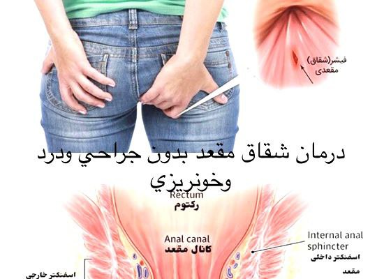 عکس مطب