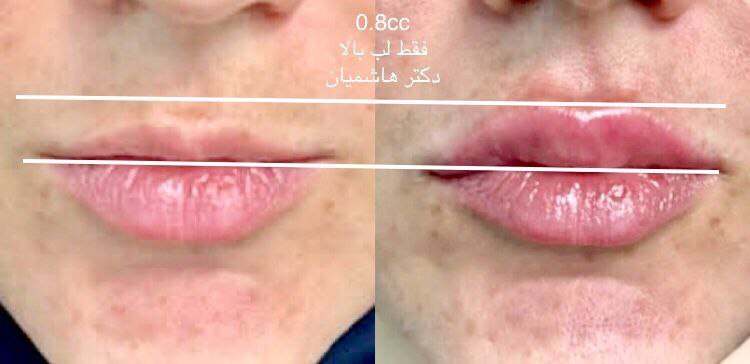 عکس مطب