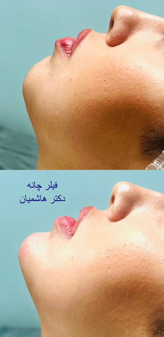 عکس مطب