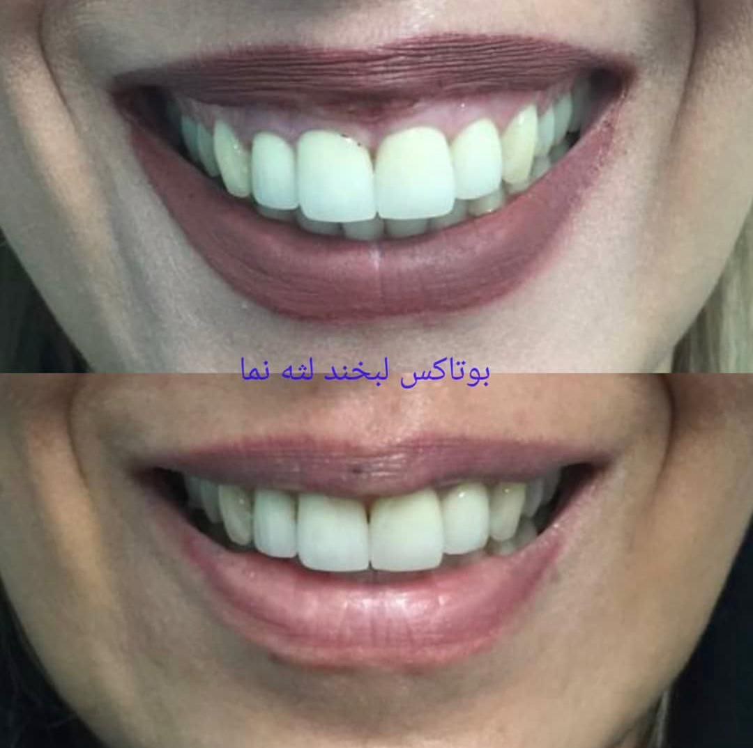 عکس مطب