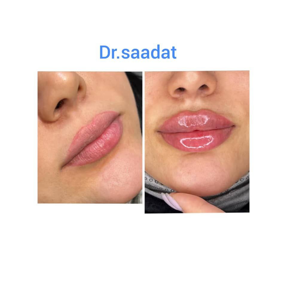 عکس مطب