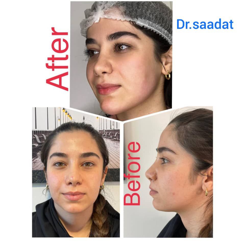 عکس مطب