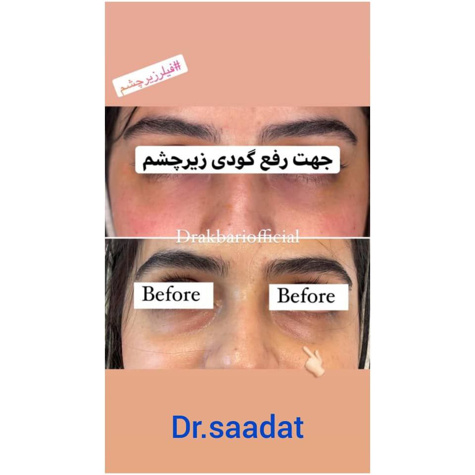 عکس مطب