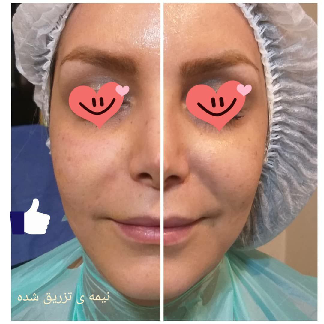 عکس مطب