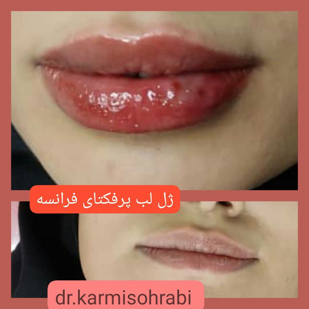 عکس مطب