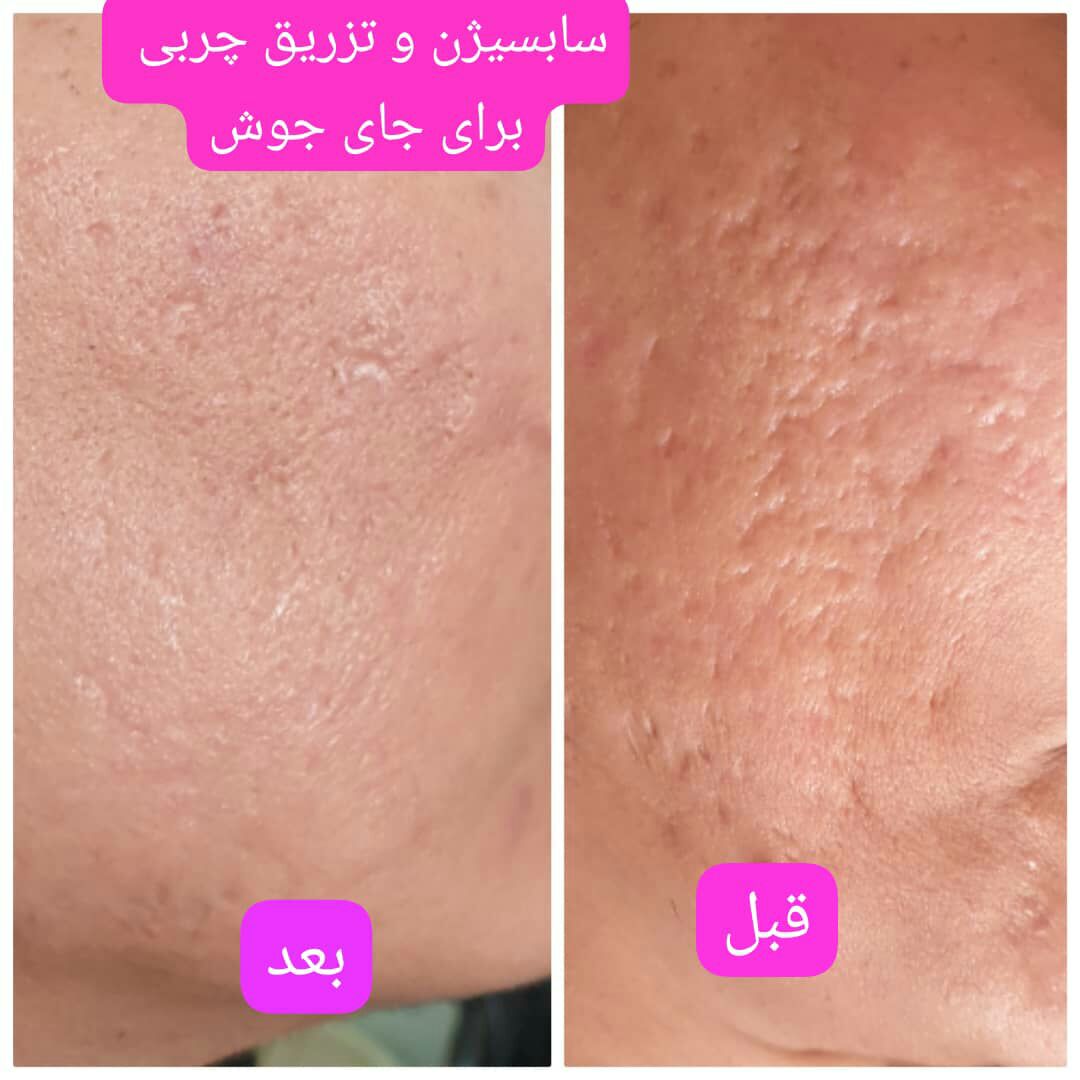 عکس مطب