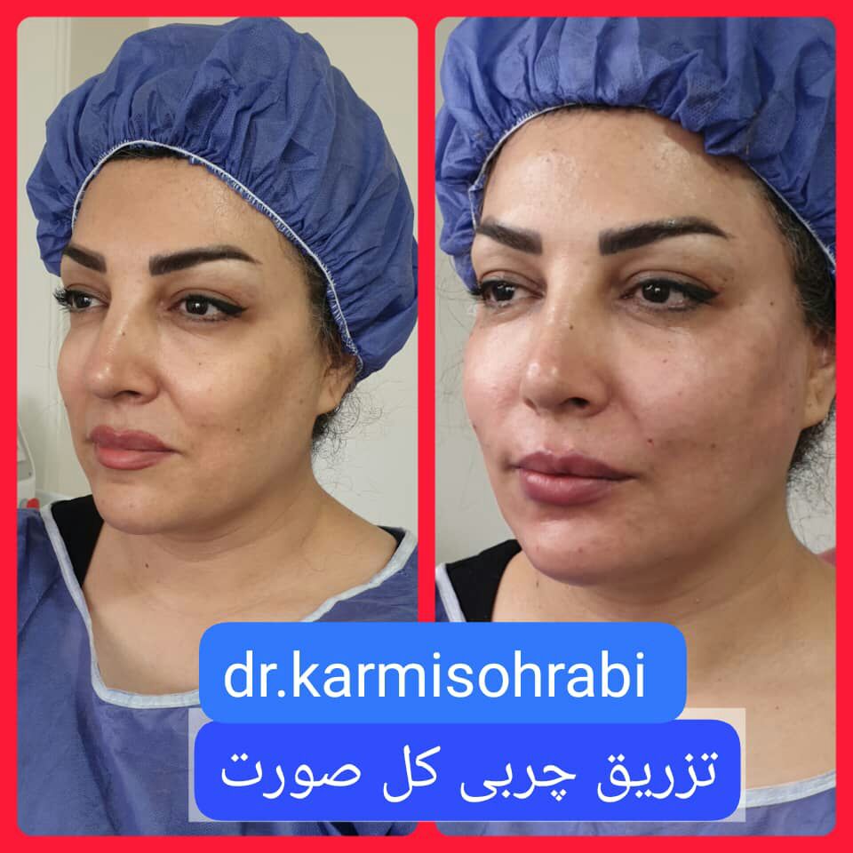 عکس مطب