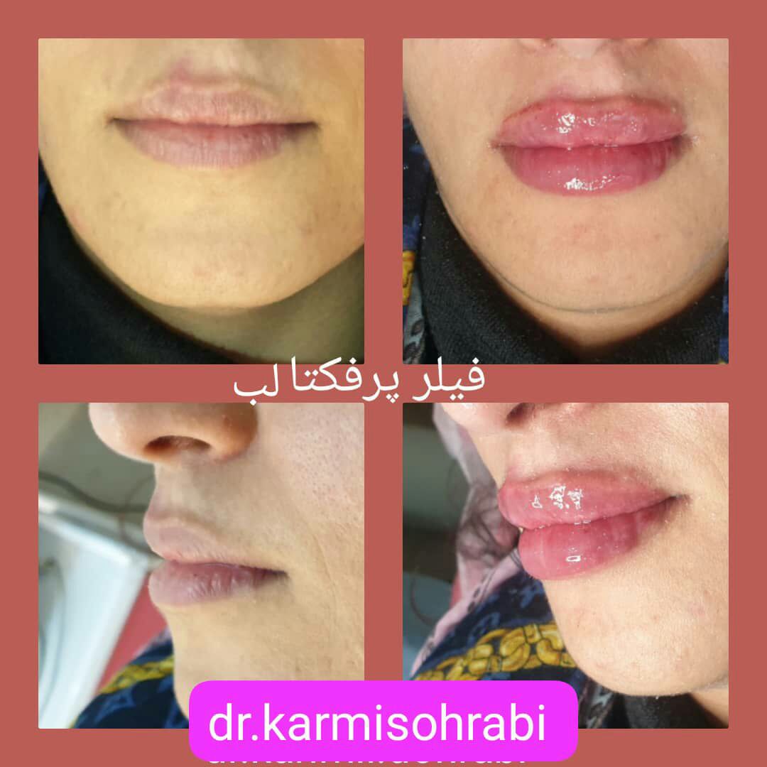 عکس مطب