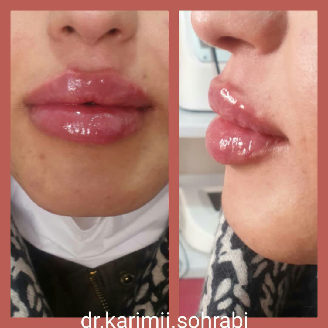 عکس مطب