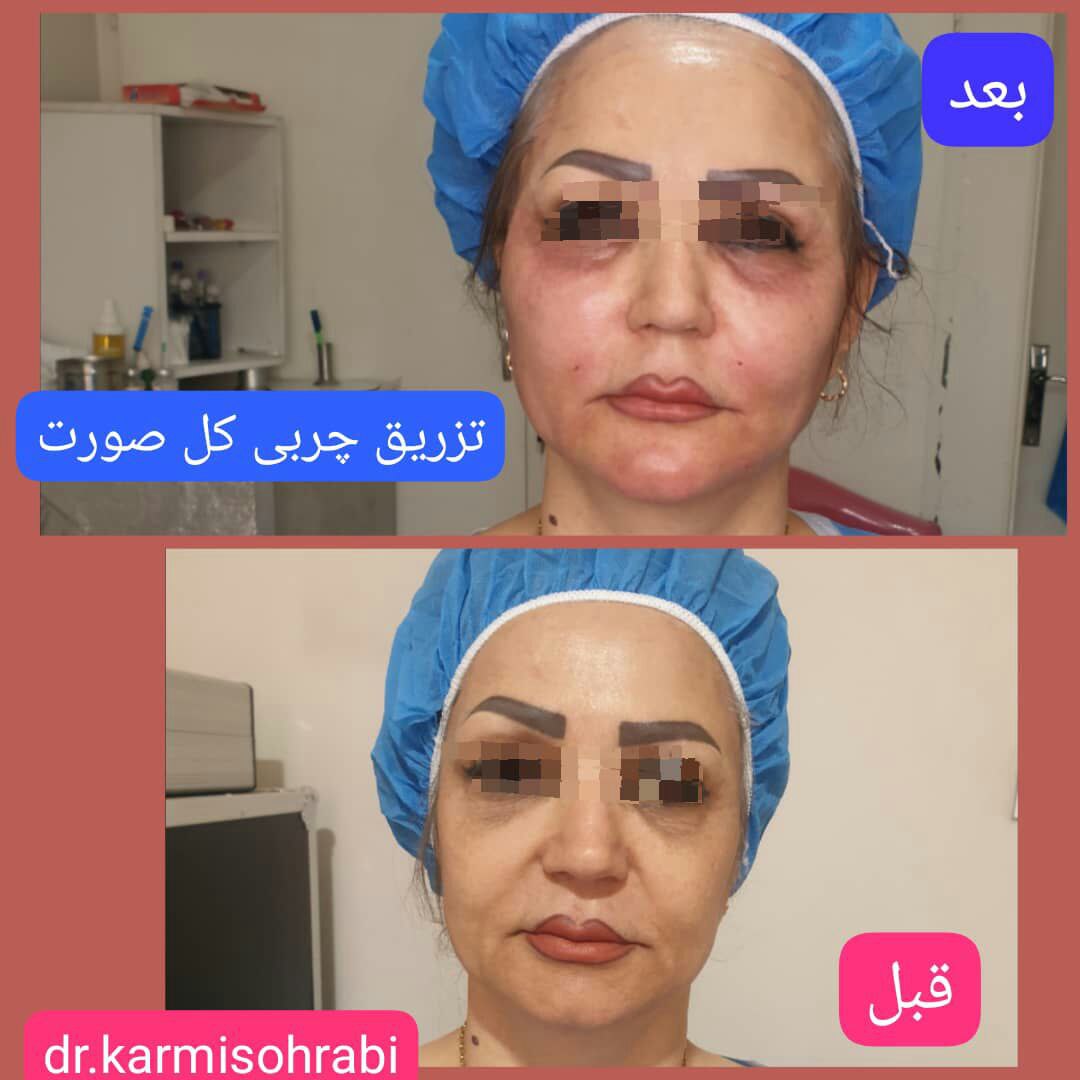 عکس مطب