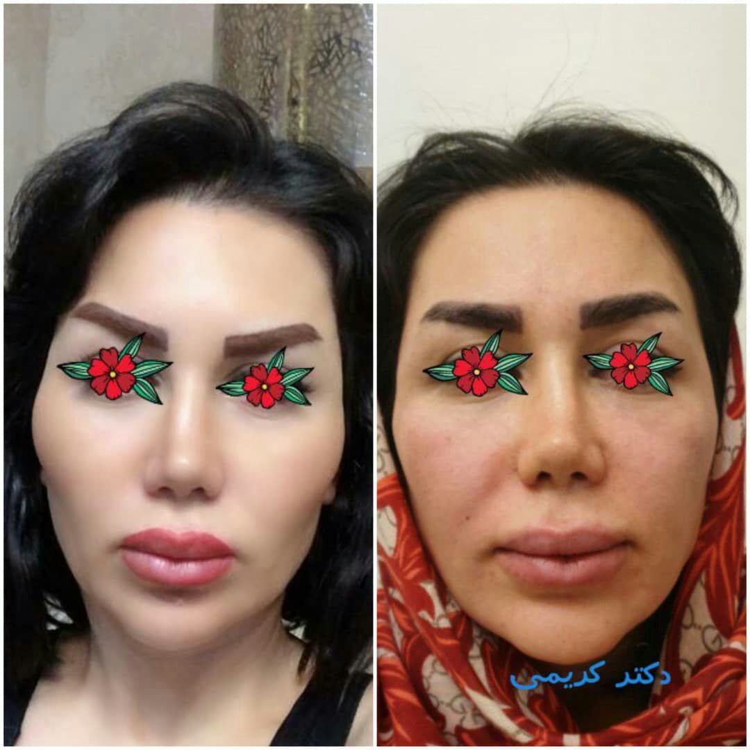 عکس مطب