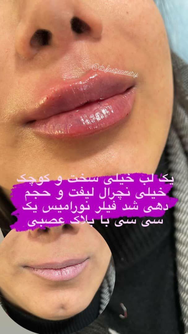 عکس مطب