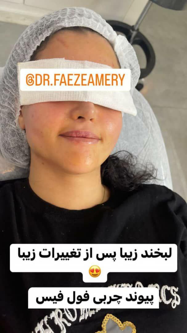 عکس مطب
