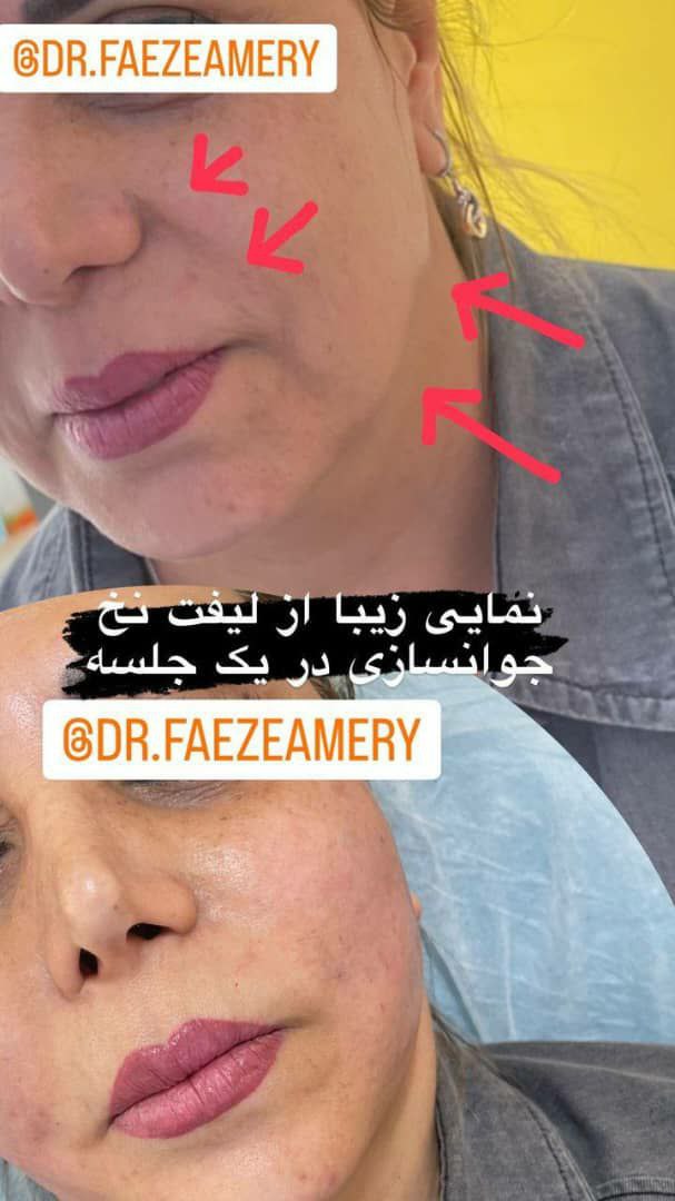 عکس مطب