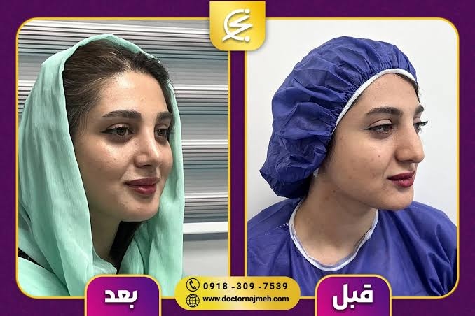 بهترین جراح بینی در کرمانشاه | راهنمای کامل انتخاب جراح بینی + معرفی دکتر نجمه برخورداری