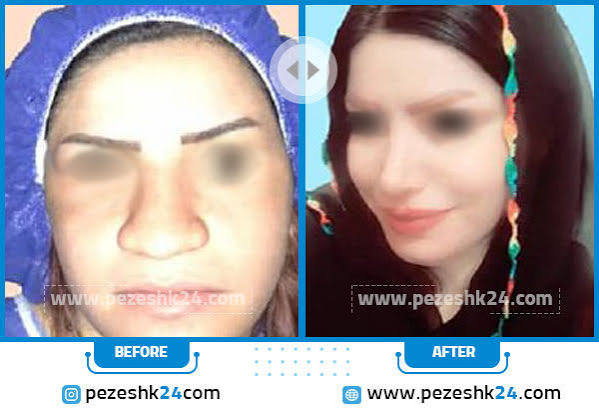 بهترین جراح بینی در کرمانشاه