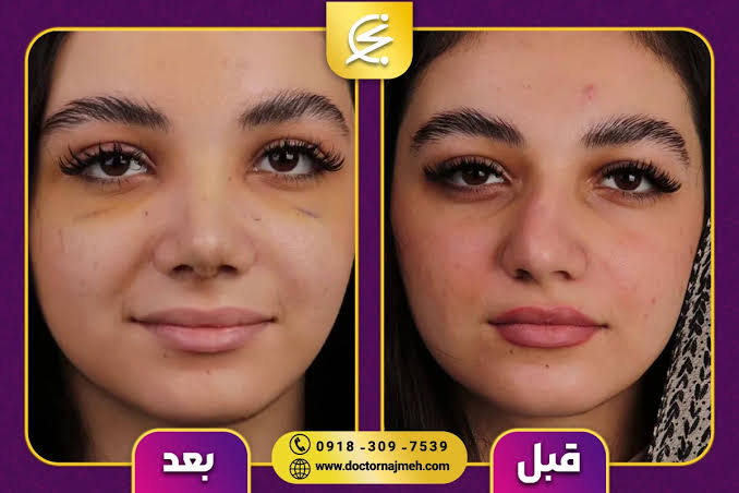 بهترین جراح بینی در کرماشاه 